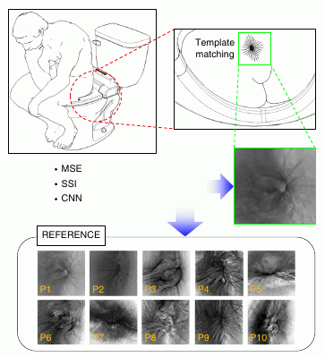 Medical analysis toilet, from https://www.nature.com/articles/s41551-020-0534-9.epdf